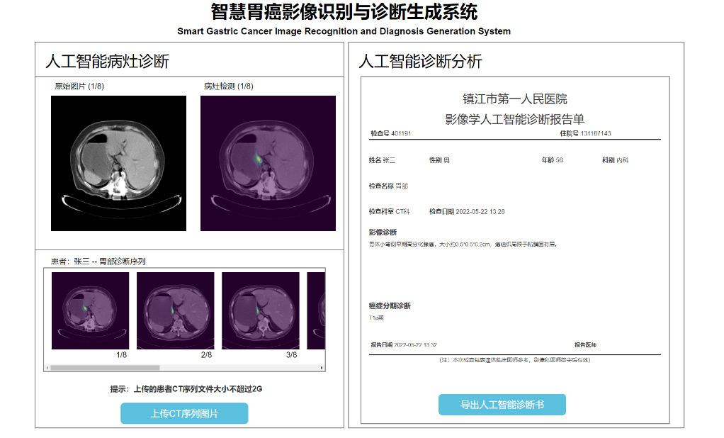 智慧胃癌影像识别与诊断生成系统